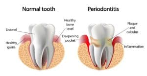 Periodontist in Spokane, WA