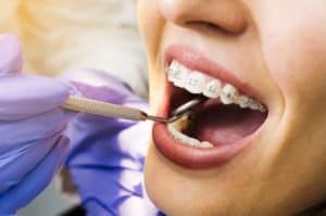 Orthodontics in Spokane