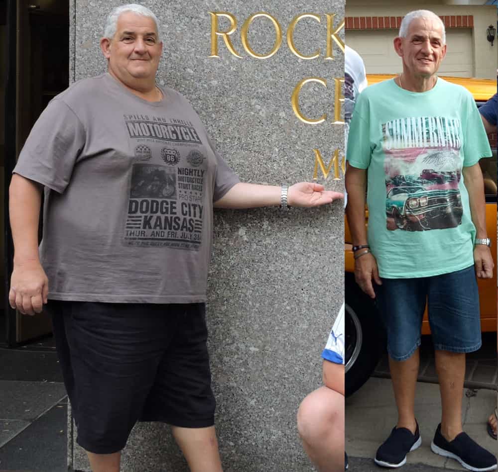 Bariatric Weightloss Surgery Testimonial