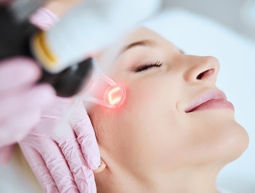 Laser Skin Resurfacing in Atlanta