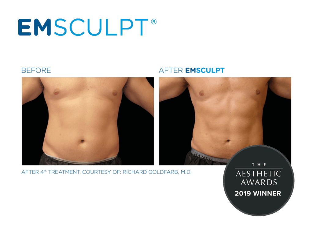 Emsculpt Boston – Min S. Ahn