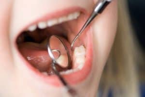 Dental Exams in Beaumont, TX