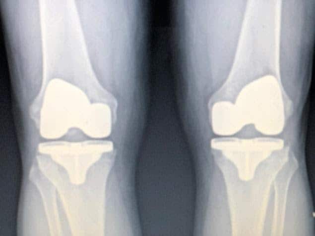 Knee X-Rays for Orthopedic Care