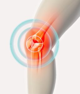 Knee Pain Imaging