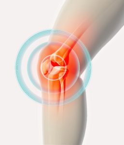 Collateral Ligament (MCL & LCL) Injury Treatment Chillicothe, Ohio