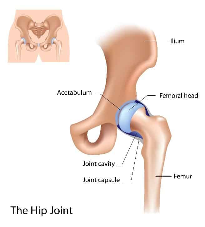 Acetabular Fracture Treatment for Columbus & Grove City, OH