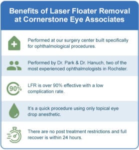 Amazing Laser Treatment Of Eye Floaters View Digital Art Amazing Laser Treatment Of Eye Floaters View Digital Art