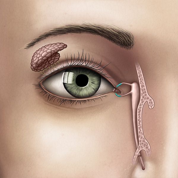 punctalplug Punctal Plug