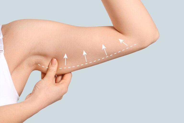 Woman exposes upper arm, pinching loose skin, as she thinks about an arm lift