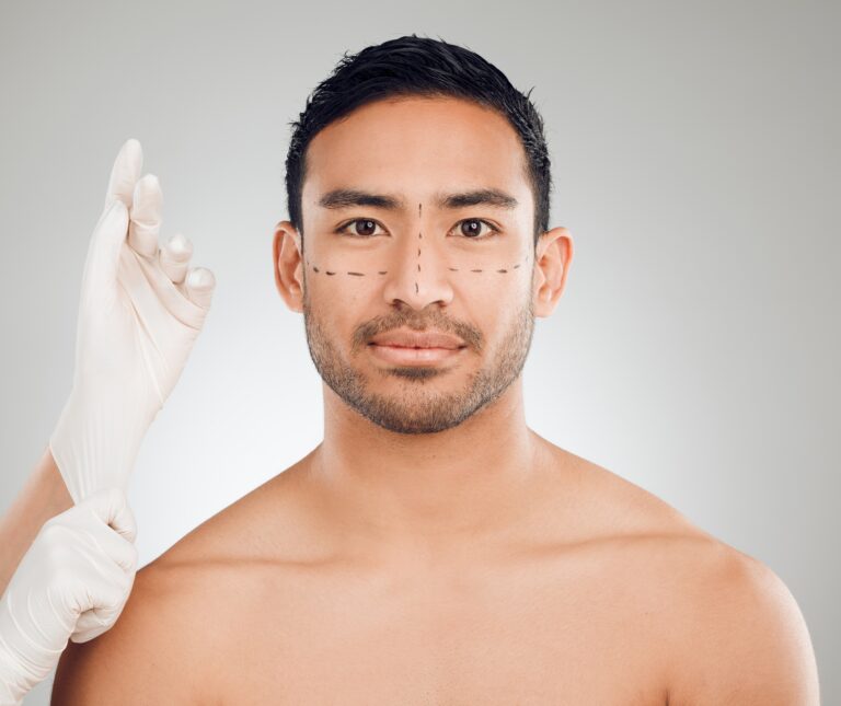 Man with surgical lines on his face before male plastic surgery