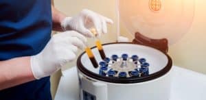 PRP Treatment Blood Samples Beverly Hills