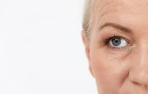 Close-up image of woman with sagging eyebrows and fine lines on her forehead, considering brow lift