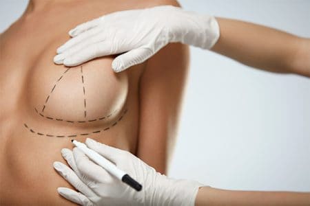 Breast Lift Smithtown, Long Island - Mastopexy Surgery Suffolk County