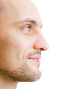 Close-up profile shot of man's face - showing his nose after reconstructive surgery