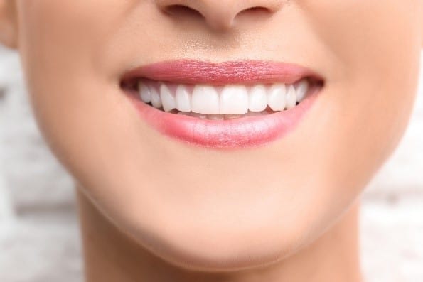Repairing Chipped Tooth Mission Viejo