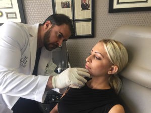 Dermal Filler Patient in Beverly Hills