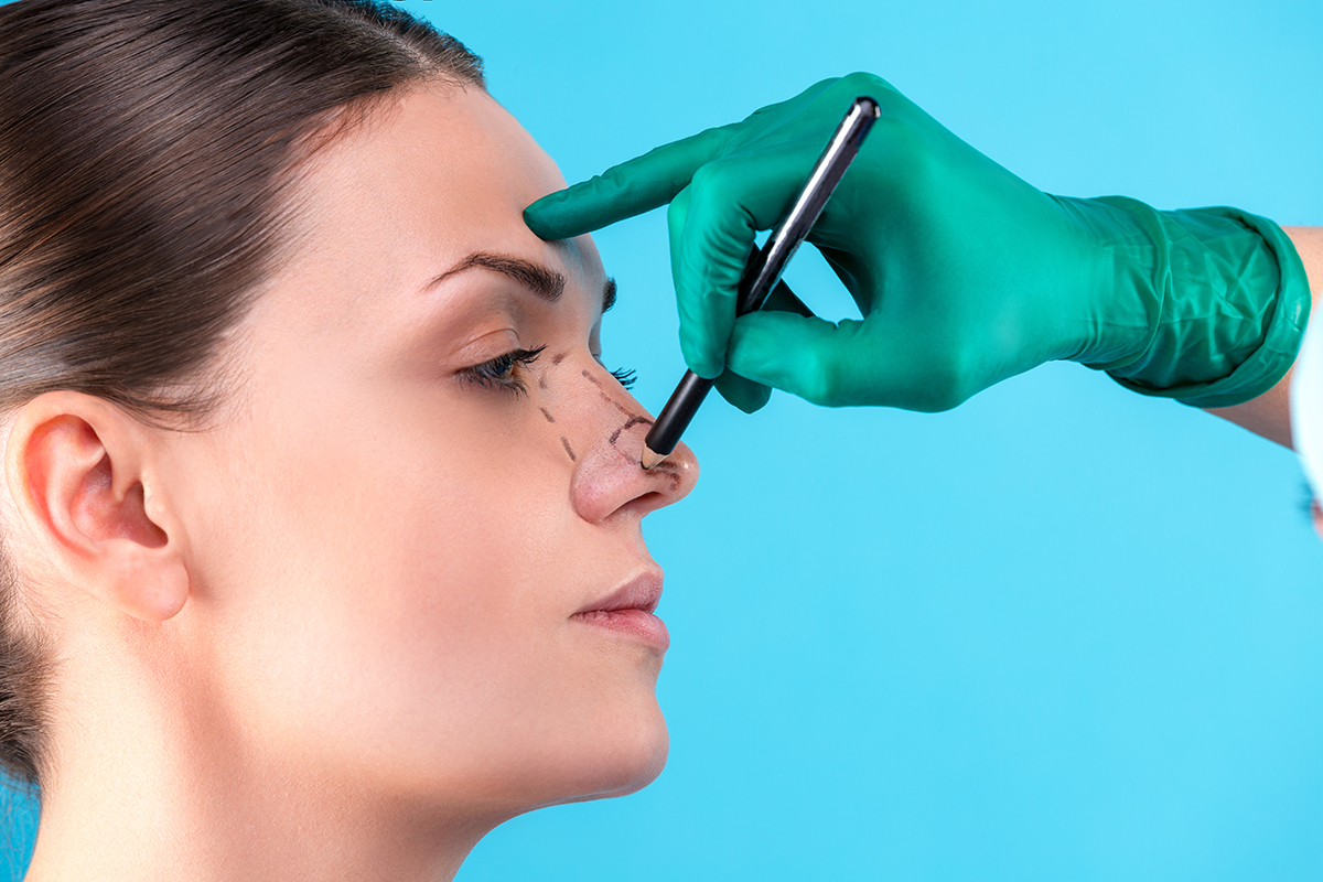 Important Questions to Ask At Your Rhinoplasty Consultation