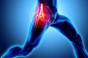 joint replacement surgery in Burr Ridge