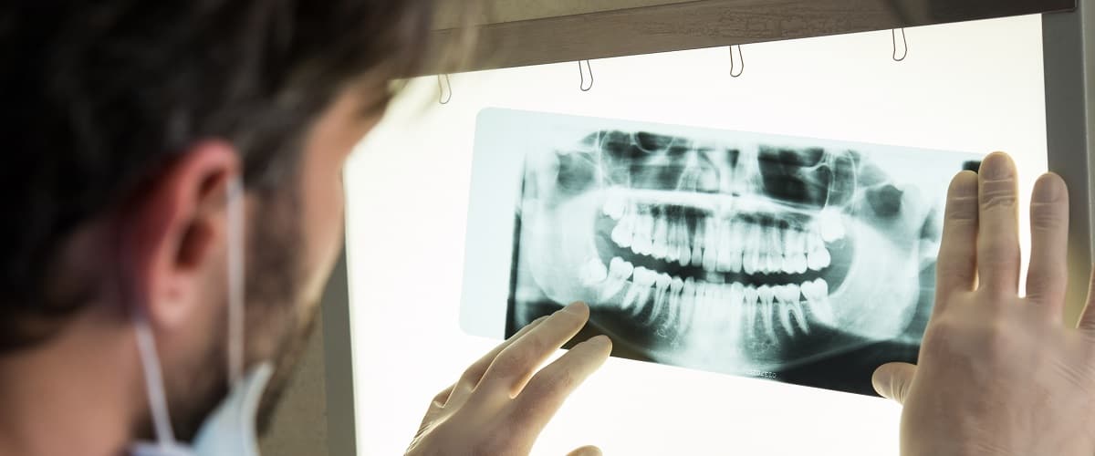 Closeup,Of,Dentist,Looking,At,Dental,X-ray,Plate