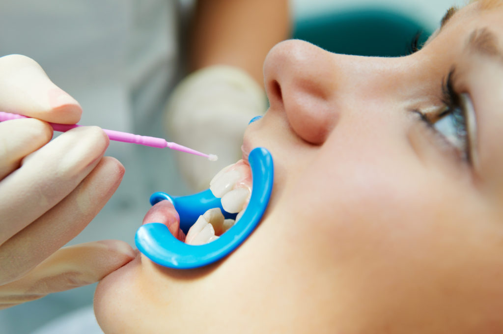 Child Receiving Dental Treatment