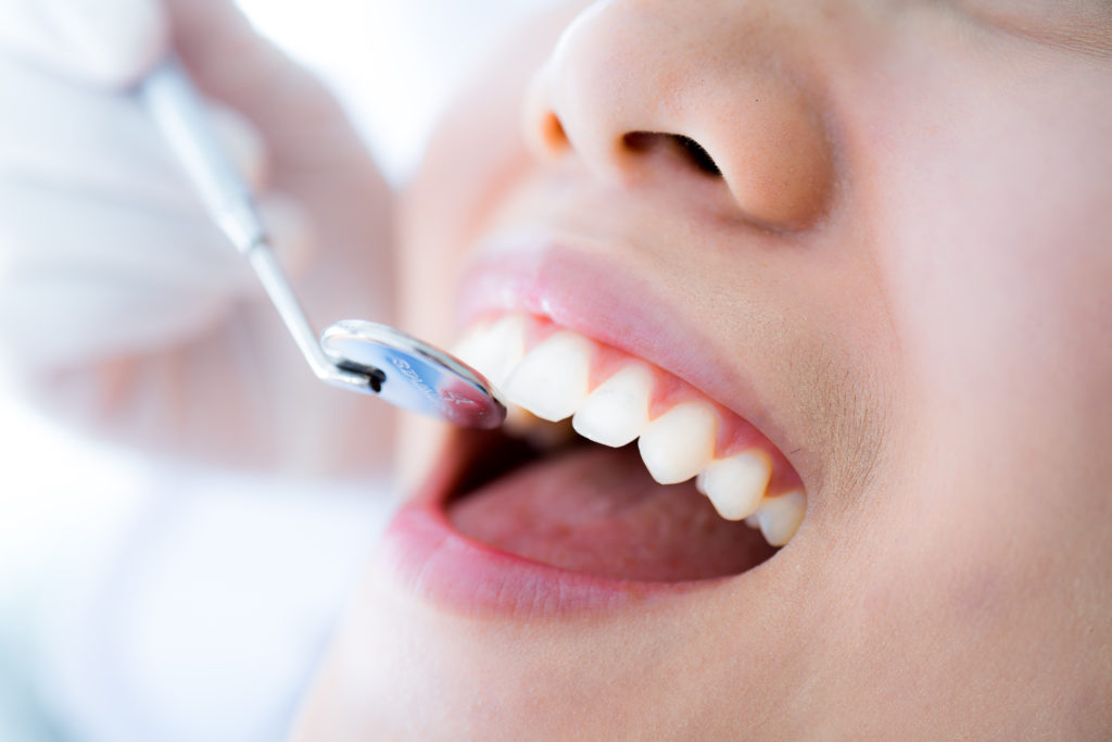 Patient in a Dental Cleaning/ Exam