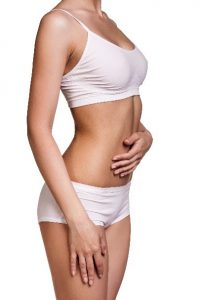 Tummy tuck and stretch marks