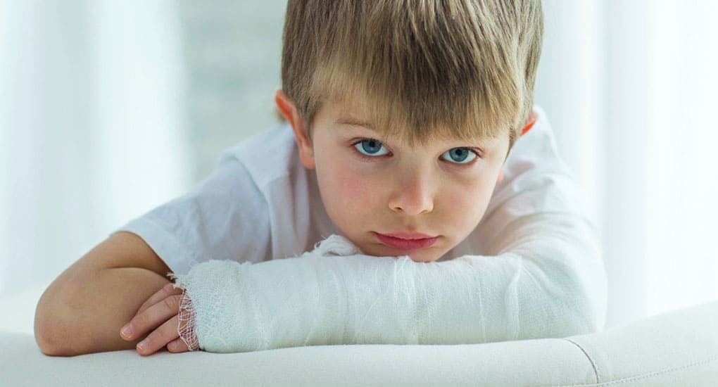 Child with a broken arm