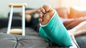 Fracture Treatment in Dearborn and Jackson, Michigan