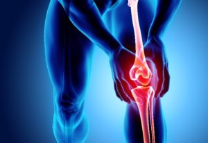 Total Knee Replacement in Dearborn and Jackson, Michigan