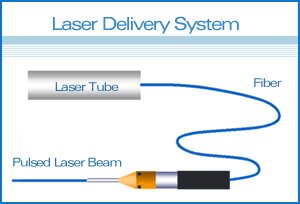 laser delivery system in NYC