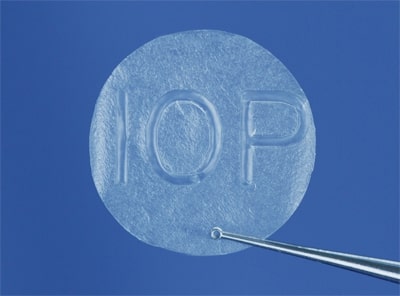 AmbioDisK: processed, dehydrated, sterilized human amniotic membrane tissue graft