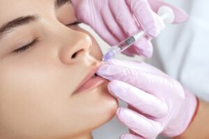 Juvéderm Fillers in Mountain View, CA