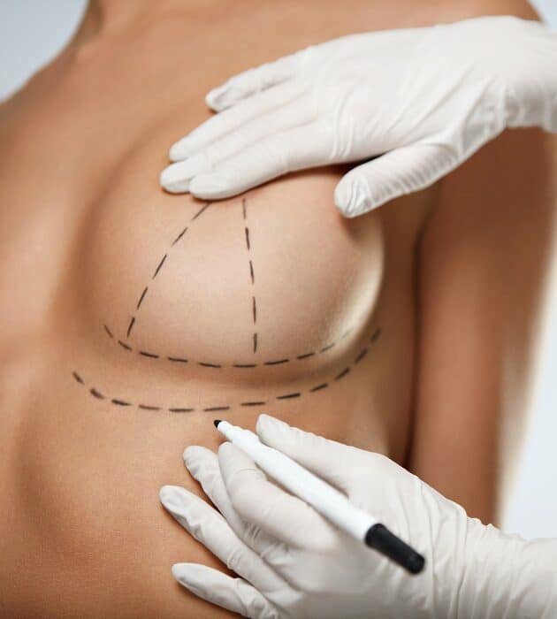 Breast Augmentation Rockford, IL - Breast Implant Surgery