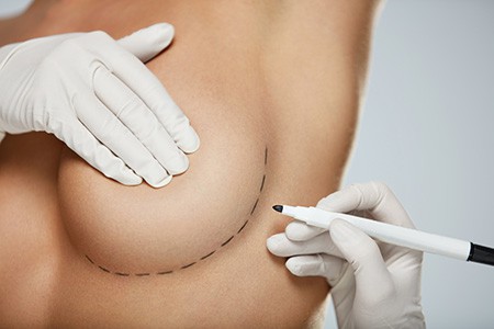 Breast Augmentation and Lift Rockford
