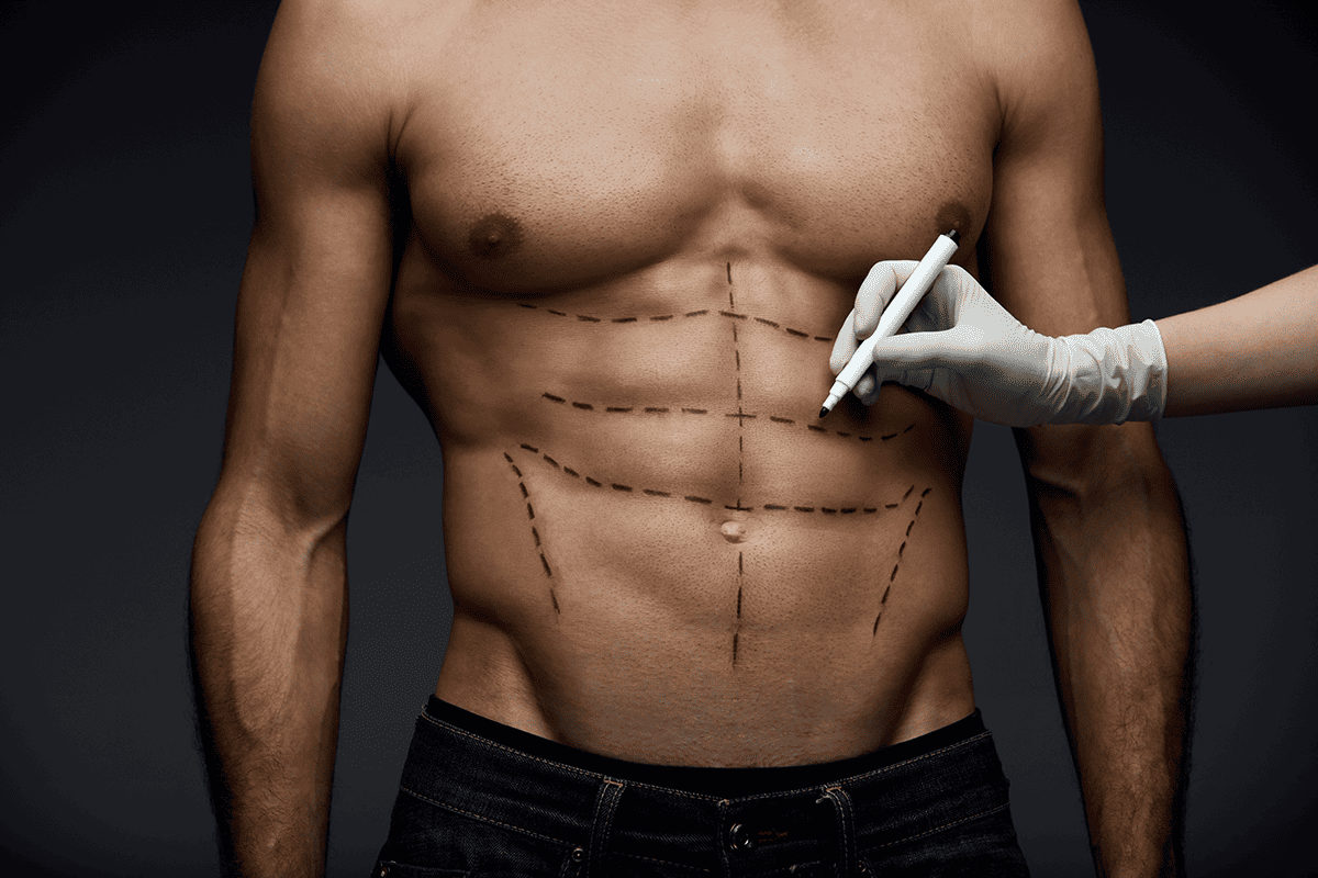 Liposuction Rockford