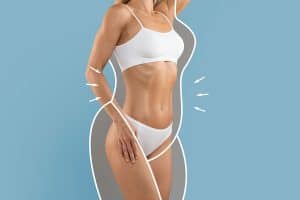 Body lift surgery in Rockford