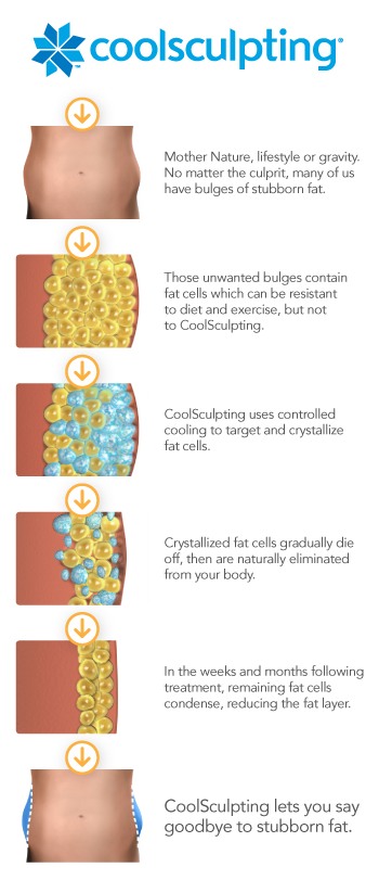 Louisville CoolSculpting Elite Procedures by Dr. Maguire