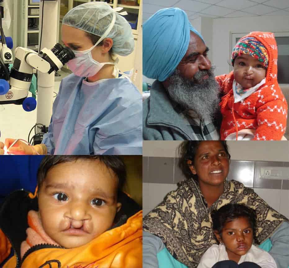 Cleft palate reconstructive surgery-patients at Plastic Surgery Group at City Centre