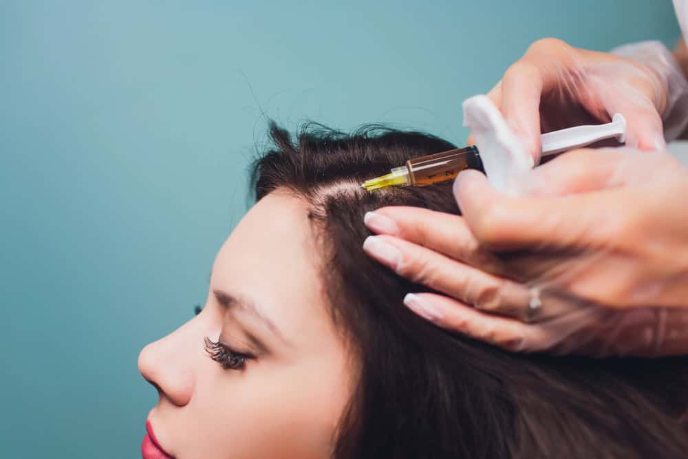 PRP hair growth injections in BC