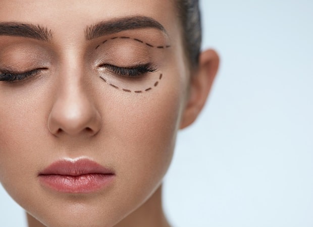 Cosmetic Eye Surgery for Clearwater & St. Petersburg, FL