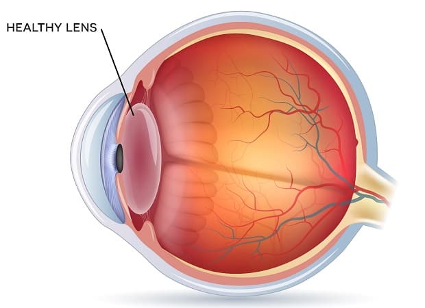Healthy Lens Eye Diagram