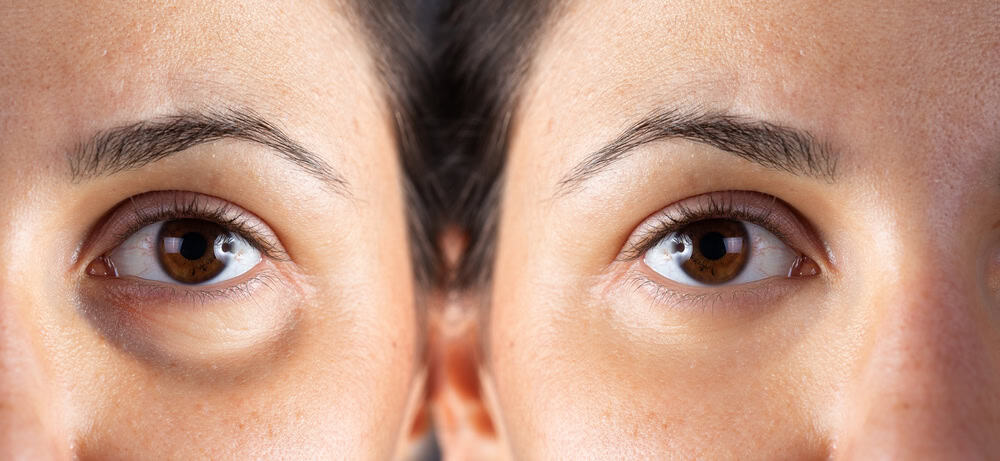 Reconstructive & Functional Oculoplastic Surgery for St. Petersburg, FL