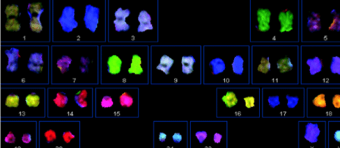 Is Low Sperm Count Genetic