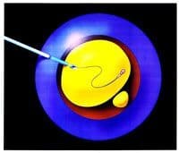 How Much Does a Reverse Vasectomy Cost San Francisco