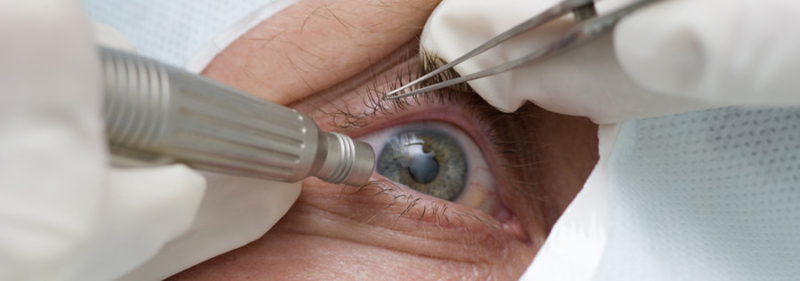 Man having cataract treated