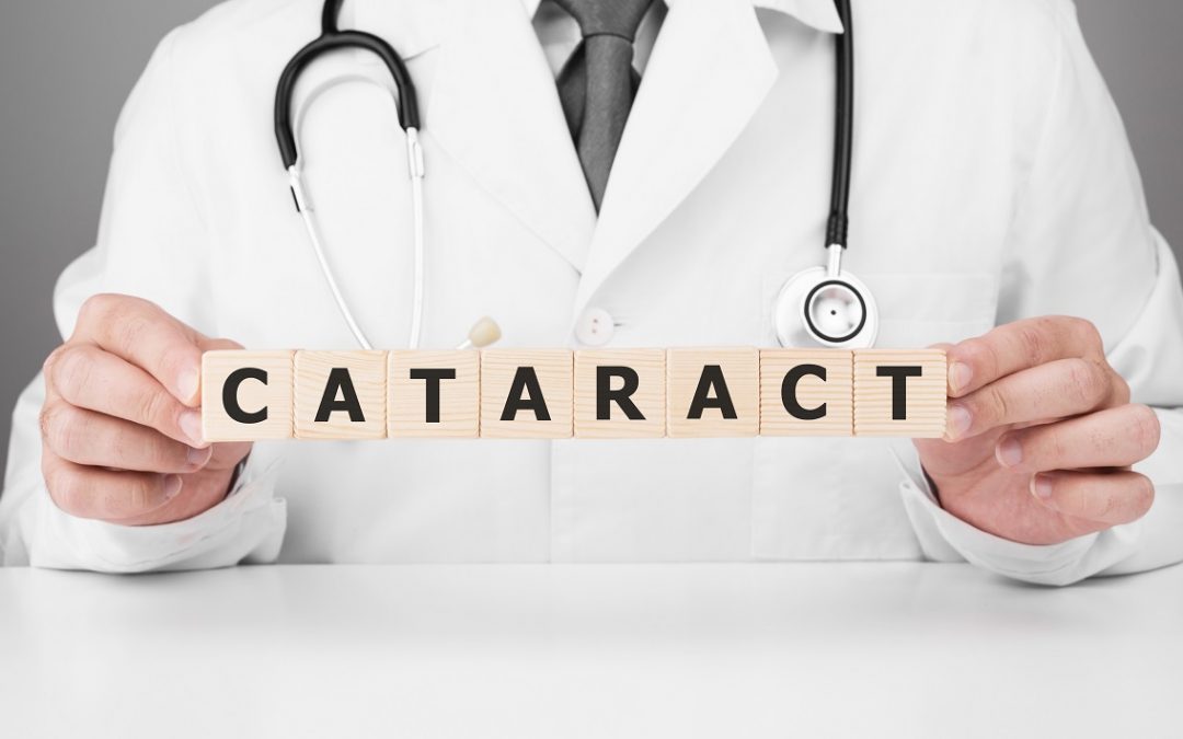 Dispelling Common Myths About Cataracts
