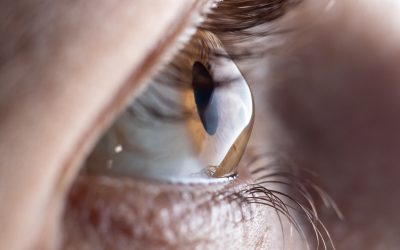 Advancements in Keratoconus Treatments