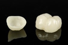 Dental Crowns in Countryside, IL
