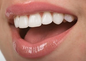 Dental Veneers in Countryside, IL