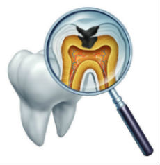 Dental Fillings for cavities in Countryside, IL